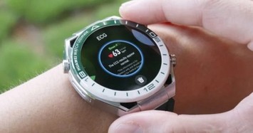 Liệu đã đến lúc mua smartwatch?