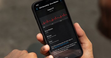 Garmin phát hành ứng dụng giúp đo điện tâm đồ trong 30 giây