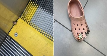 Bé gái gãy ngón chân khi đi thang cuốn vì dép crocs