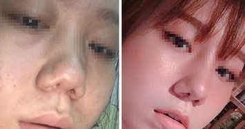 Vụ khách hàng tố Klain Beauty Center làm hỏng mũi: Công ty TNHH Klain bị phạt vì dính nhiều vi phạm