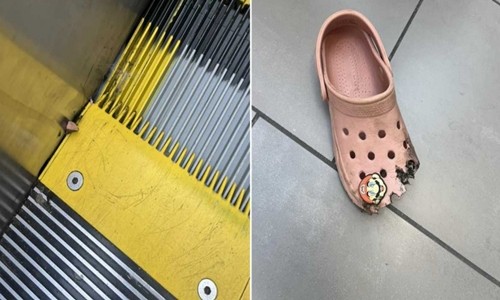 Bé gái gãy ngón chân khi đi thang cuốn vì dép crocs