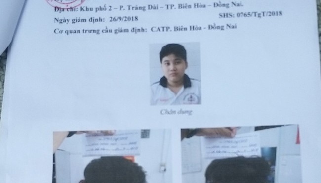Bé trai 13 tuổi bị đánh thương tật 15% nhưng gần 1 năm công an vẫn chưa khởi tố vụ án 
