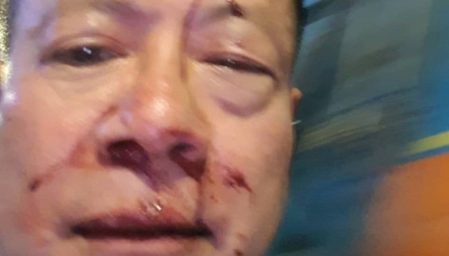 Nhóm thanh niên đánh Việt kiều bê bết máu trong quán karaoke ở Sài Gòn