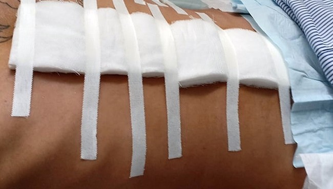 Giang hồ Hùng Sứt cùng đàn em nổ súng bắn 4 người bị thương