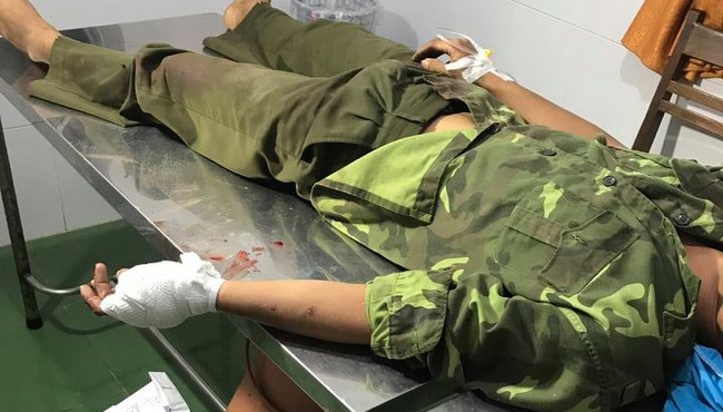 Hàng chục lâm tặc chém đứt gân tay 1 kiểm lâm để giải cứu đồng bọn