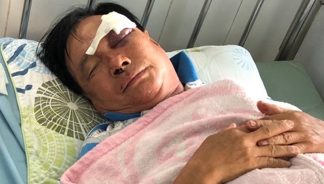 Con rể và người yêu của con gái cầm chai bia đánh cha vợ tới tấp