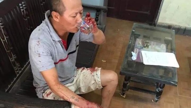 Hiện trường vụ anh trai giết 4 người trong gia đình em ruột rồi vào nhà uống trà