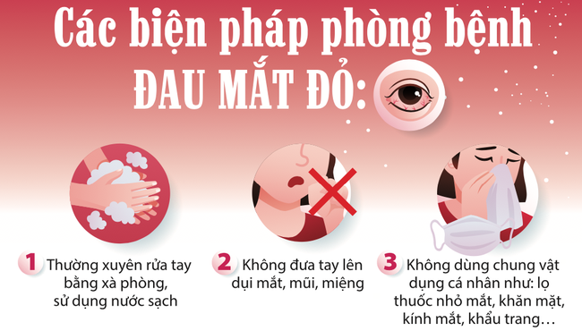 Bệnh đau mắt đỏ gia tăng: Những biện pháp phòng tránh bệnh đau mắt đỏ 