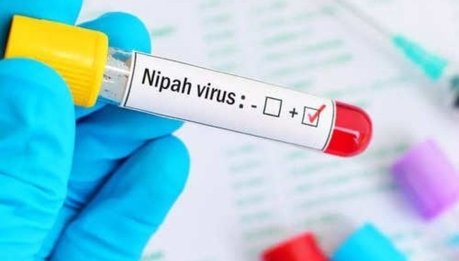 Virus Nipah bùng phát, tỷ lệ tử vong tới 75%