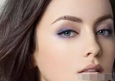 Những nốt ruồi may mắn không nên loại bỏ - Hình 3 Nhung not ruoi may man khong nen loai bo-Hinh-3