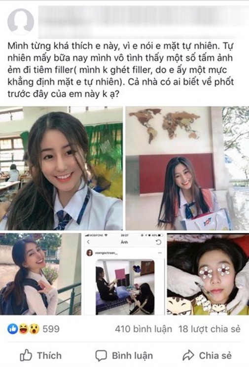 Hotgirl nguc khung noi gi ve nghi van dao keo?-Hinh-5