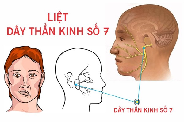 Bat dieu hoa ca dem, chang trai bi bien dang guong mat-Hinh-4