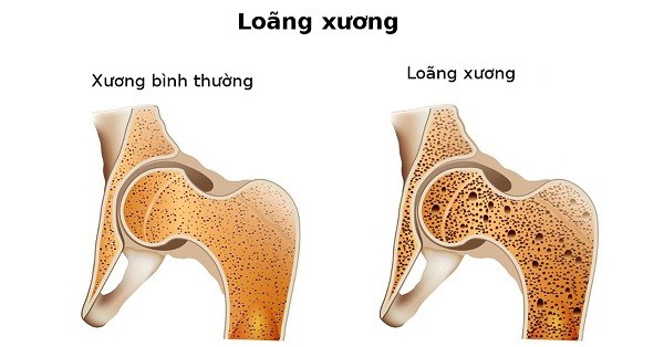 Mua xuan la 'thoi diem vang' bo sung canxi-Hinh-2