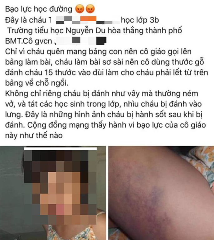 Dak Lak: Tin moi nhat vu co giao danh hoc sinh lop 3 tim dui-Hinh-2