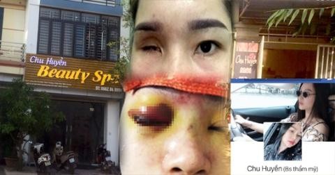 Spa Chu Huyen noi gi khi lam mu mat co gai tiem filler nang mui?