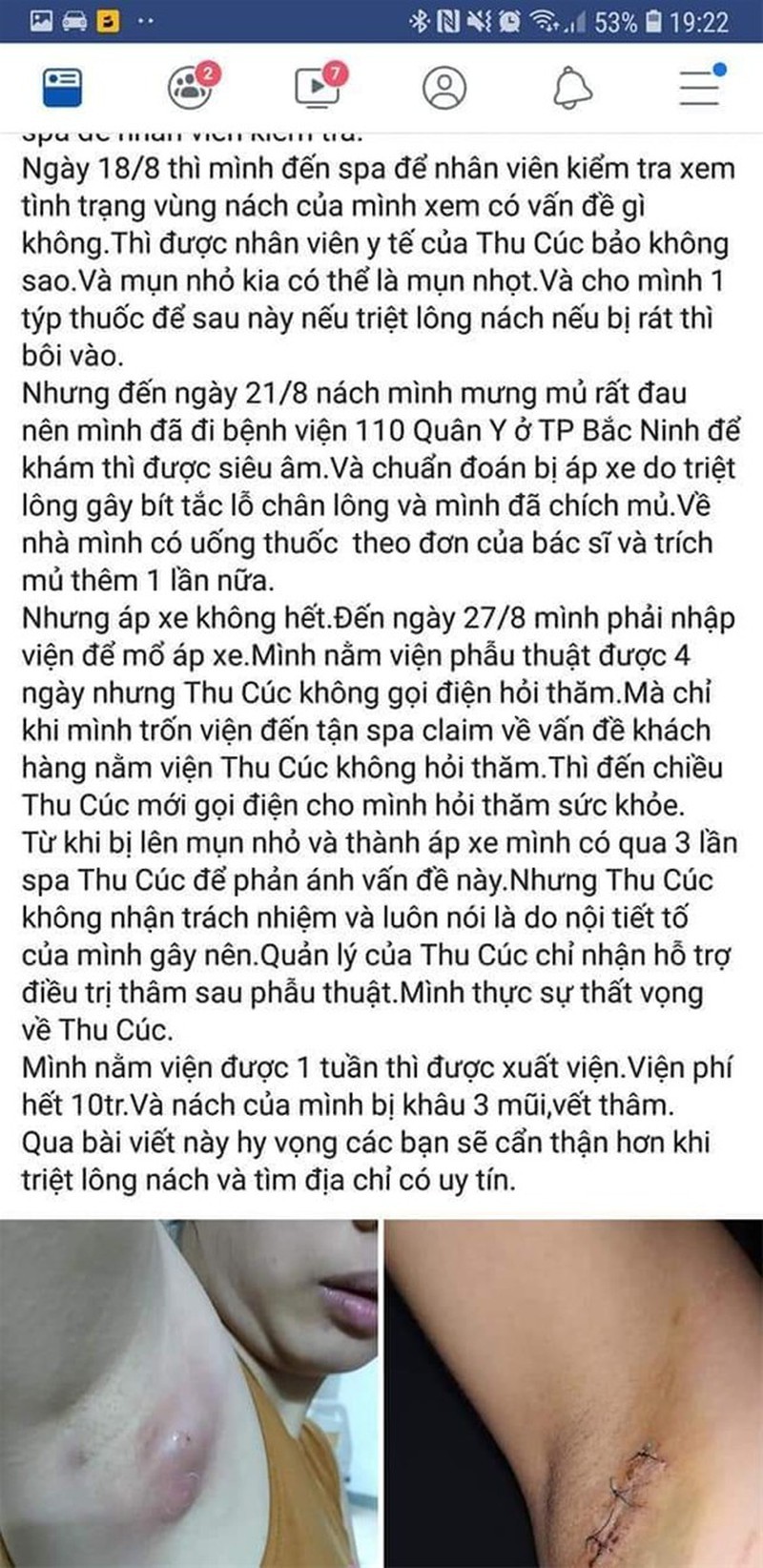 Bi to phan biet benh nhan, Benh vien Thu Cuc tung dinh nhung 'phot' gi?-Hinh-2