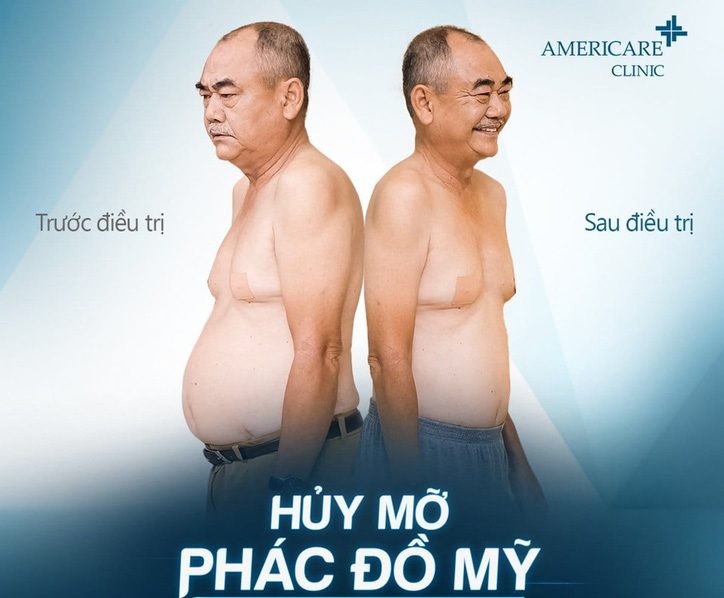 Nghe si nao tham gia quang cao giam mo bung cho Americare clinic?-Hinh-2