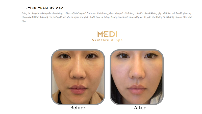 Medi Skin Care & Spa lua khach hang quang cao dich vu kham, chua benh?-Hinh-3