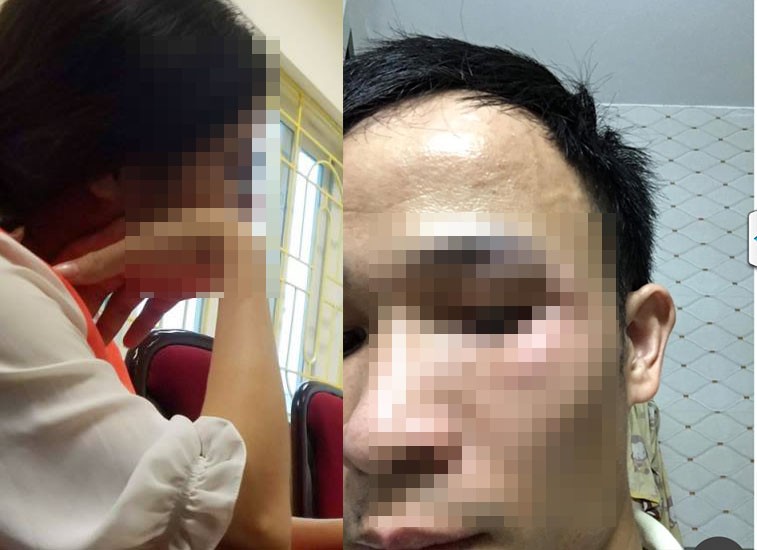 Đề nghị khởi tố thanh niên tấn công phụ nữ mang bầu ở Hà Nội - Hình 2 De nghi khoi to thanh nien tan cong phu nu mang bau o Ha Noi-Hinh-2