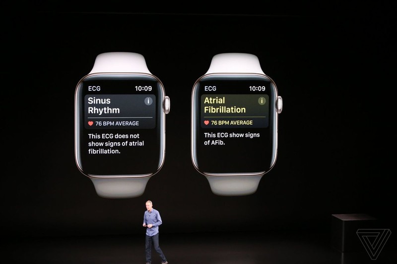 Apple Watch Series 4 co dang de ban 